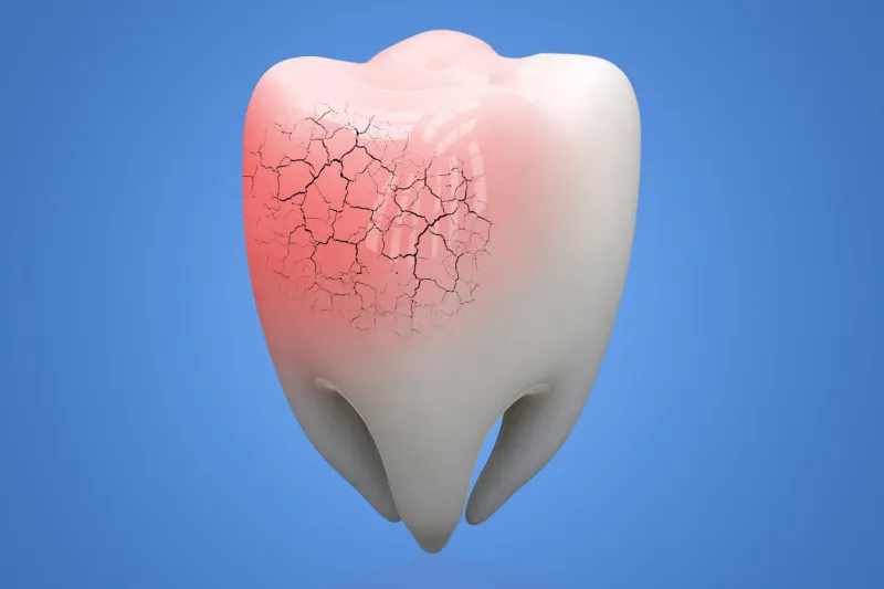 broken human tooth on blue background 3d illustration