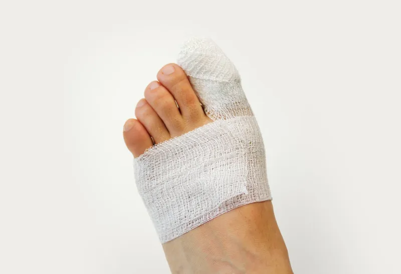 high angle view of cropped shot of recently operated toe woman with bandages isolated on white background