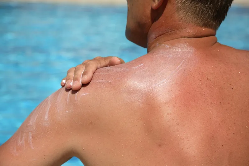 drawing on a skin of the cream protecting from solar burns