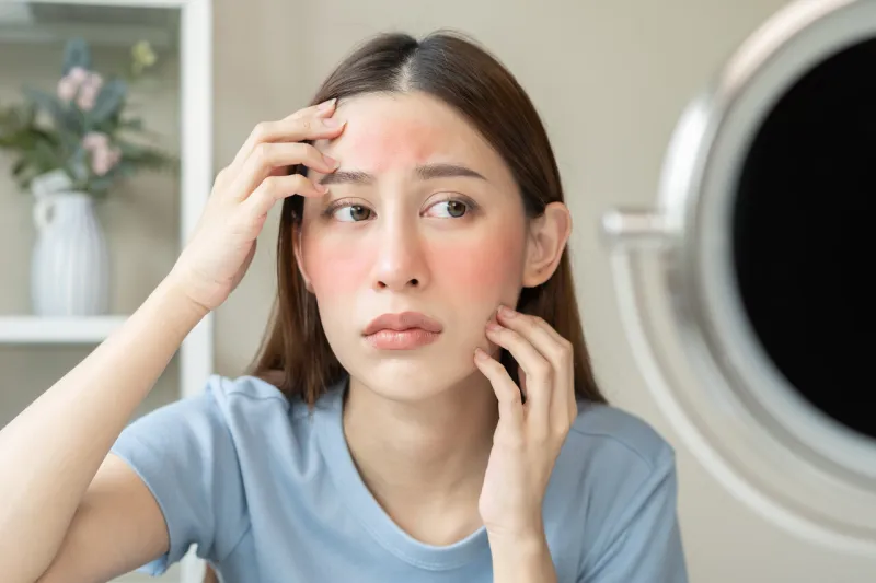 dermatology, scratch asian young woman looking at mirror, expression worry and itch, itchy allergy or allergic sensitive reaction, red spot or rash on her face beauty care from skin problem treatment