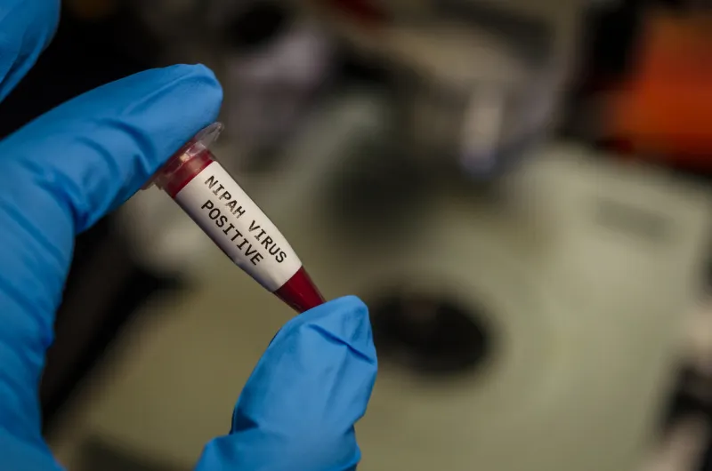 cropped hand holding sample with nipah virus text on bottle