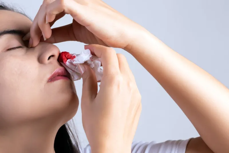 nosebleed , a young woman with a bloody nose healthcare and medical concept