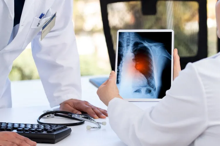 radiology and medicine concept doctor explaining the results of scan lung on digital tablet screen to patient with long covid