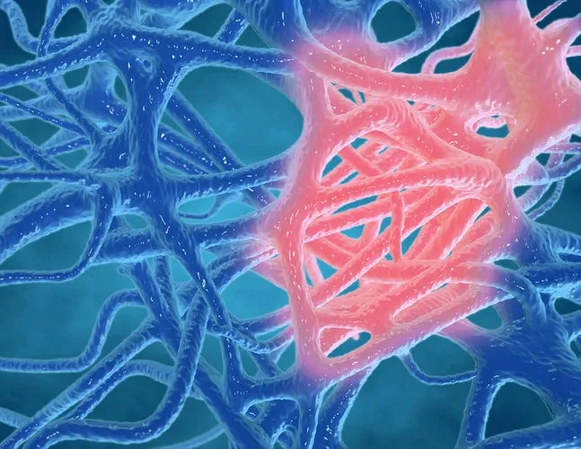 inflammation concept, inflammated human tissues 3d rendering