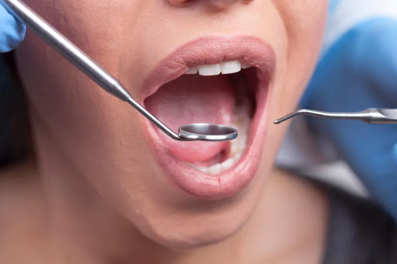 belle jeune femme se faire vérifier les dents