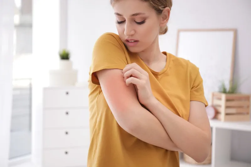 woman scratching arm indoors, space for text allergy symptoms
