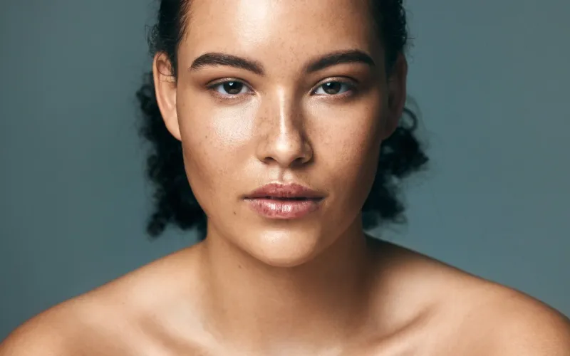 skincare, portrait and woman in studio for beauty, wellness and acne treatment, progress or results on blue background, face, skin and girl model with melasma, pigmentation and cosmetics for pimples