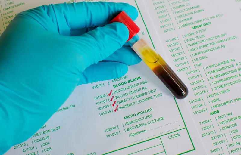 blood bank testing