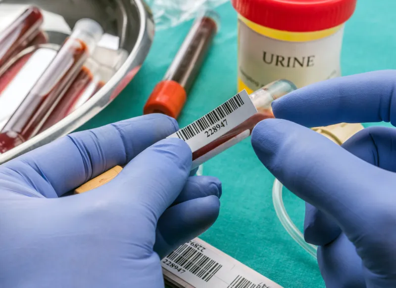 doctor holds blood sample at a hospital table, conceptual image