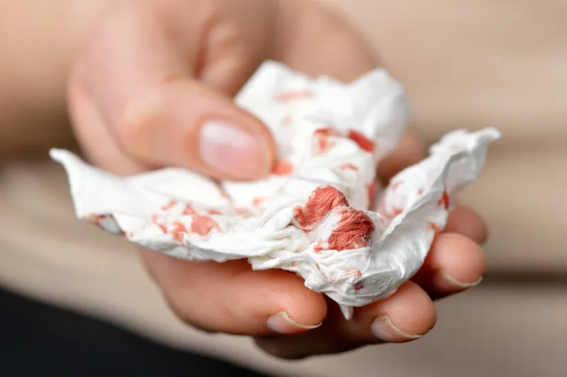 photo of hands holding a napkin with blood