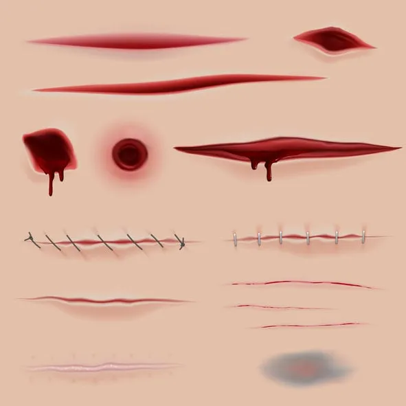 skin scars cuts and wounds set in vector