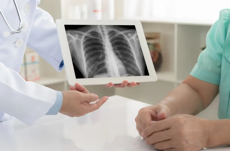 medical x-ray concept doctor explaining the results of scan lung on digital tablet screen to patient