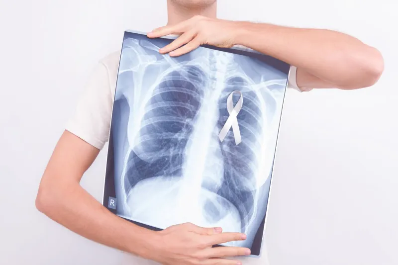 oncological lung cancer disease concept guy male man holding medical lung body x-ray photo with pinned white ribbon as a symbol of lung cancer on white isolated background