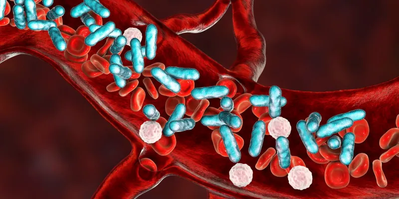sepsis, bacteria in blood 3d illustration showing rod-shaped bacteria with red blood cells and leukocytes