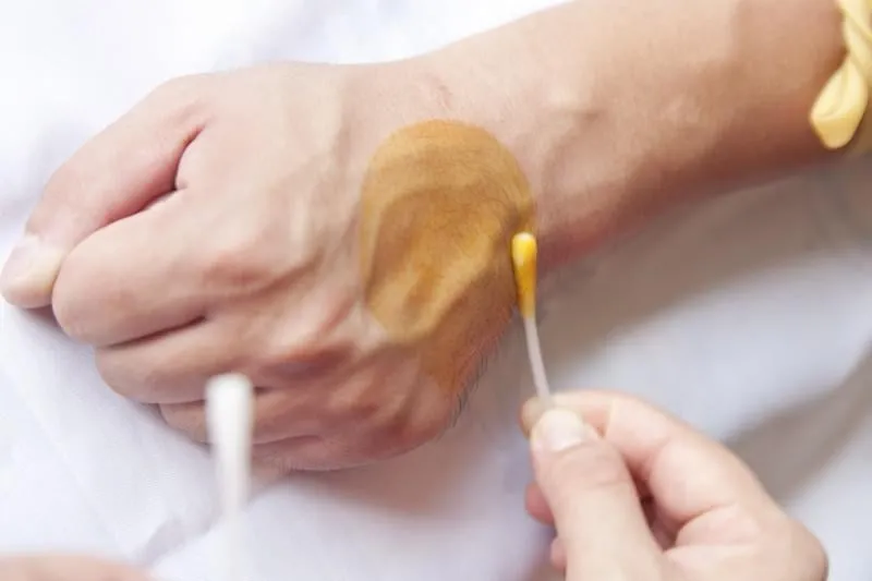 désinfecter la peau du patient avec de l'iode ou de la bétadine juste avant de prendre une perfusion intraveineuse