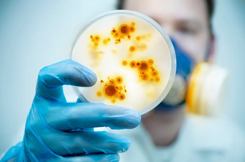 science and lab researcha scientist holding a petri dish with virus and bacteria cells