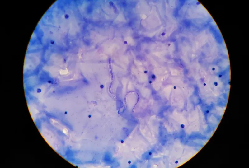 microfilaria tissue parasite infection to human in parasitology