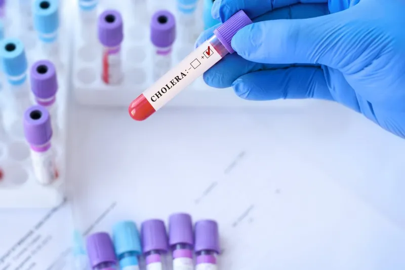 doctor holding a test blood sample tube with cholera test on the background of medical test tubes with analyzes