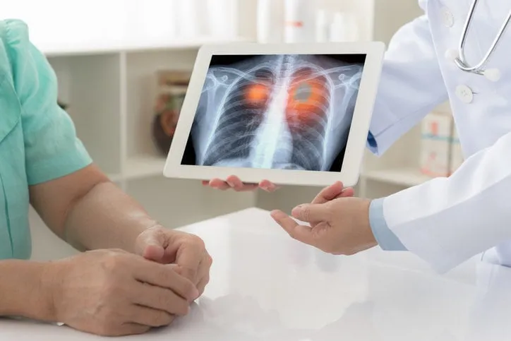 lung cancer concept doctor explaining results of lung check up from x-ray scan chest on digital tablet screen to patient