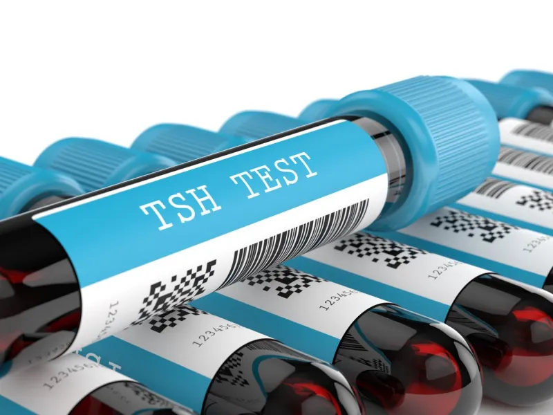 3d render of tsh test blood tubes over white background