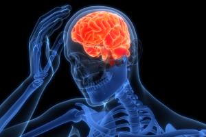 AVC en tournant la tête