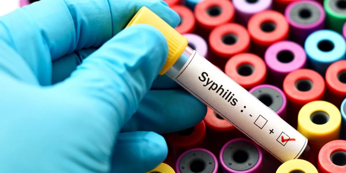 blood sample positive with syphilis