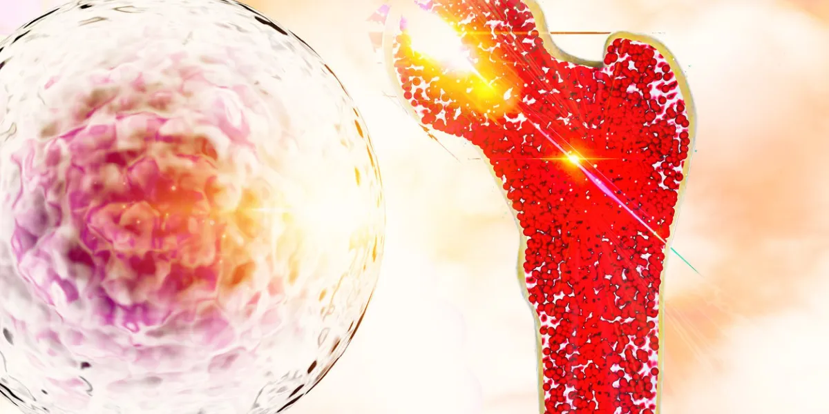 bone research concept bone cancer and stem cells treatment osteoporosis bone marrow bone problems diseases 3d rendering