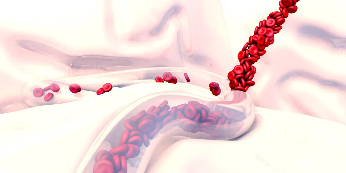 3d illustration brain hemorrhage