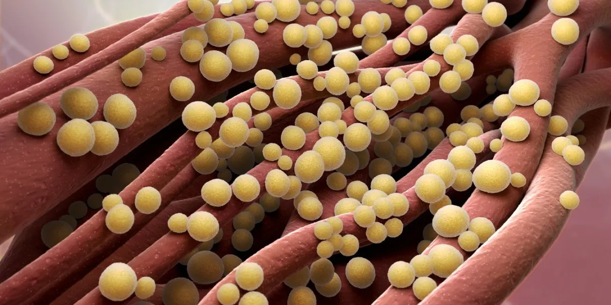 staphylococcus aureus