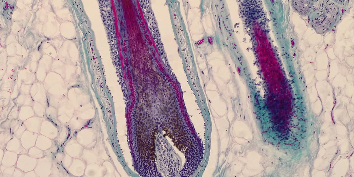 microscopic picture (400x magnification) of roots of hair in human head skin hair follicles