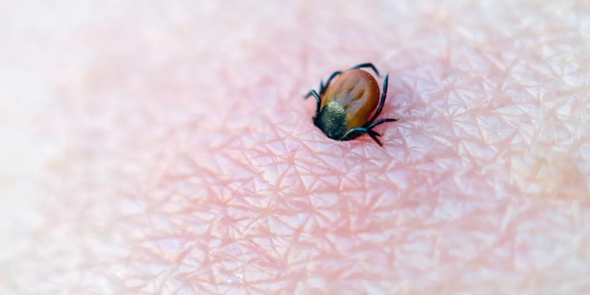 the tick sucked into the human skin macrophotograpy