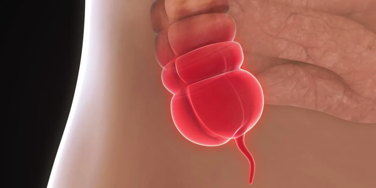 appendix pain illustration 3d render