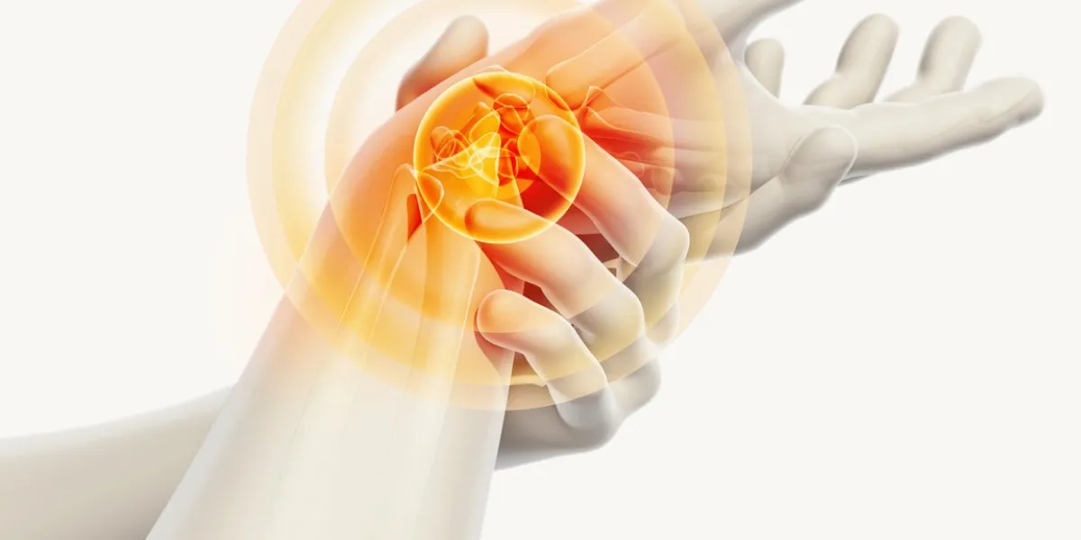 wrist painful - skeleton x-ray, 3d illustration medical concept