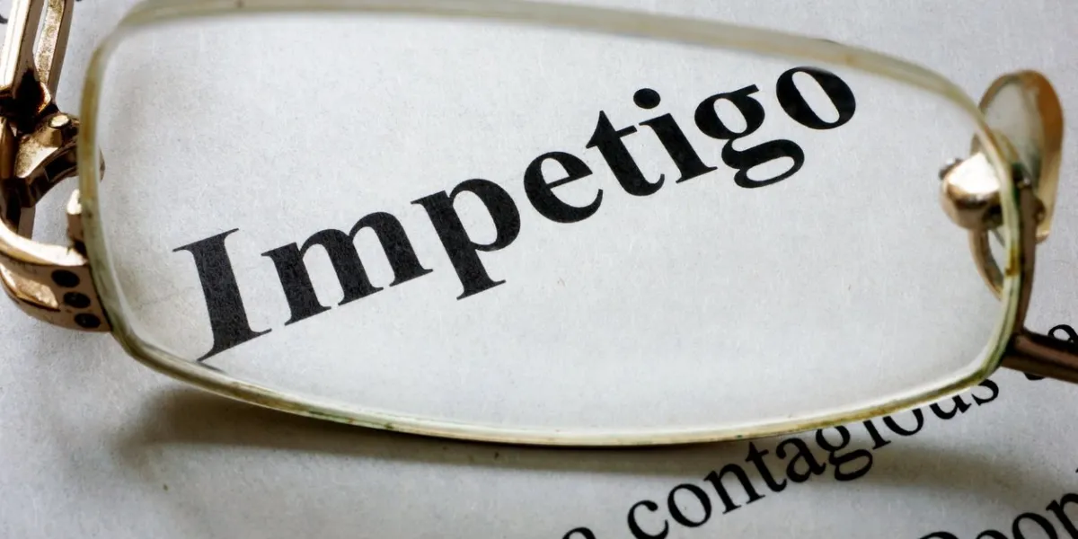 paper with word impetigo and glasses medical concept