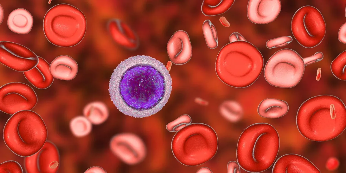 hemotransfusion in treatment of anemia, 3d illustration showing two populations of red blood cells, small hypochromic red blood cells and normal a small lymphocyte is drawn for size comparison