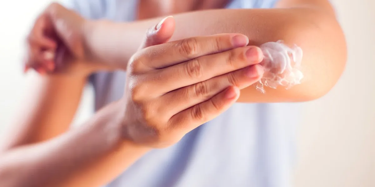 woman applies cream on dry elbowpeople, healthcare and medicine concept