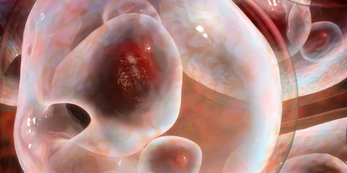 hydatid cyst of echinococcus multilocularis, closeup view, 3d illustration e multilocularis is a parasitic worm that causes alveolar echinococcosis with production of cysts in liver