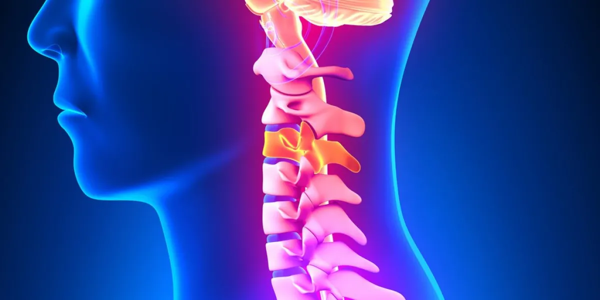 c3 disc - cervical spine