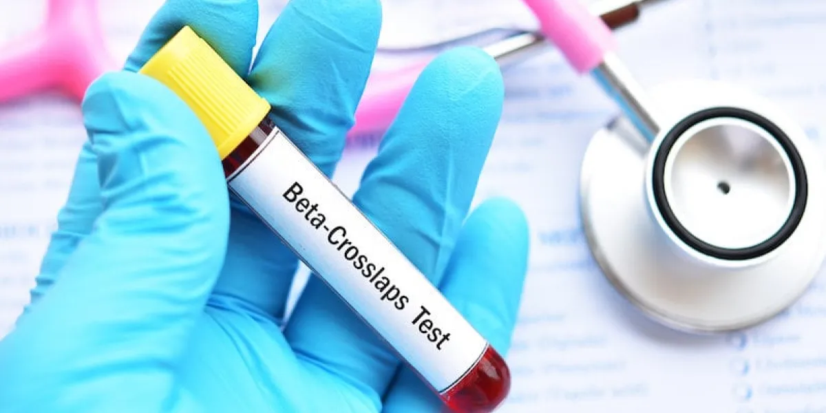 blood sample tube for beta-crosslaps or beta-ctx test, diagnosis for bone disease