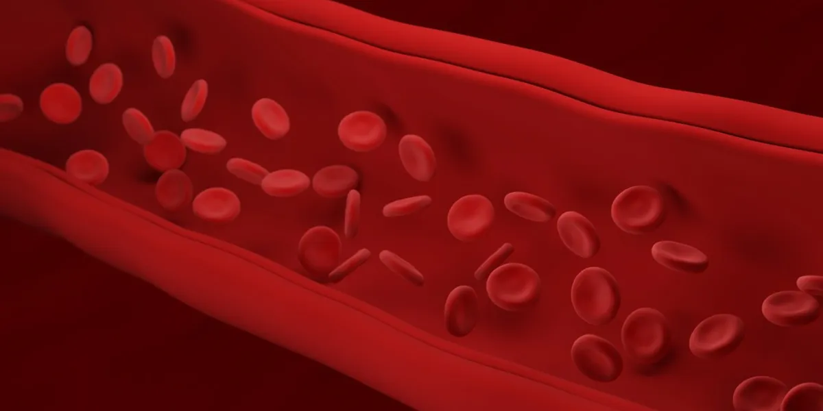 atherosclerosis red blood cells artery build up of plaque loss of elasticity of the walls of arteries thickening and hardening blood flow 3d illustration