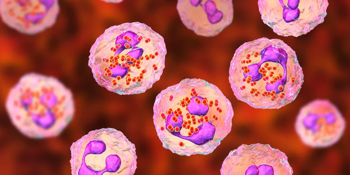 meningococcal meningitis, cerebrospinal fluid smear containing neutrophils with and without bacteria neisseria meningitidis, 3d illustration