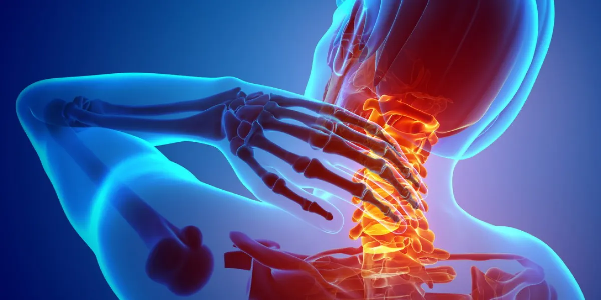 3d illustration of men feeling the neck pain