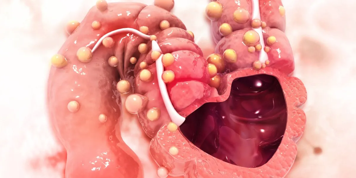 human colon, colon anatomy, cross section, colon disease, scientific background, 3d illustration