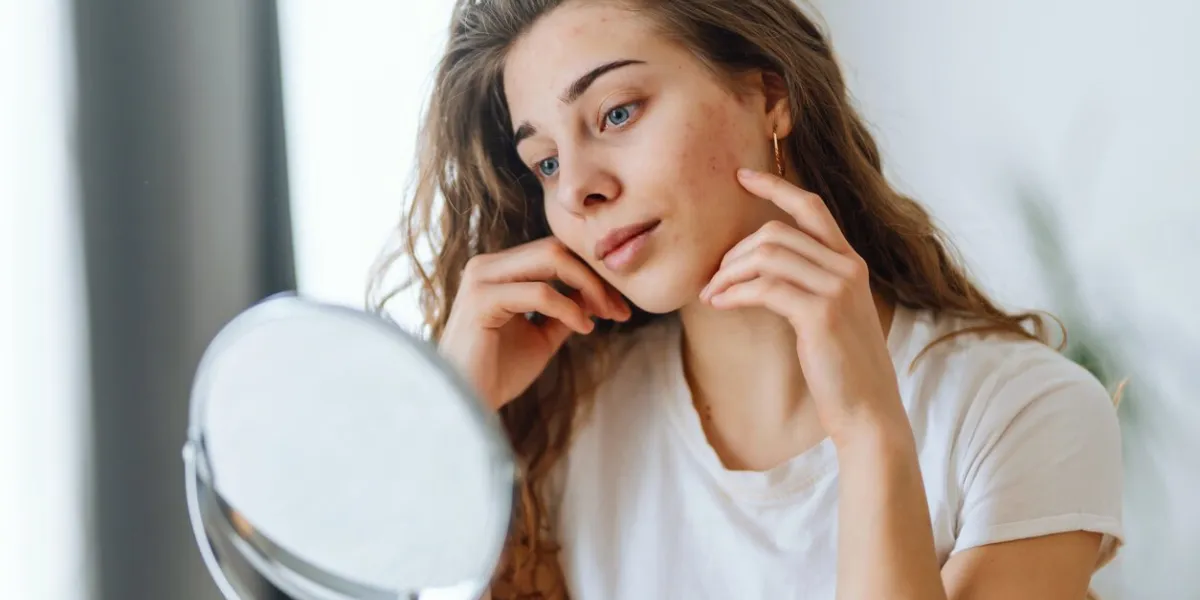 young woman with problem skin looking into mirror
