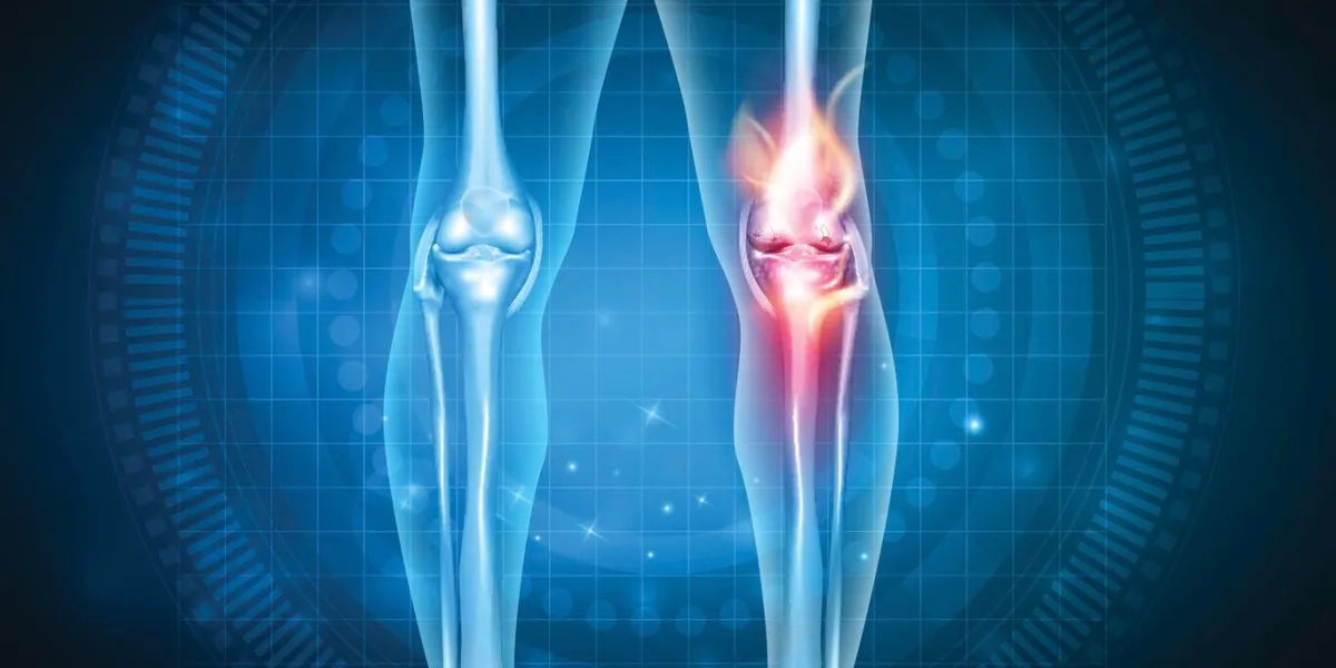 joint problems bright abstract design, burning damaged knee