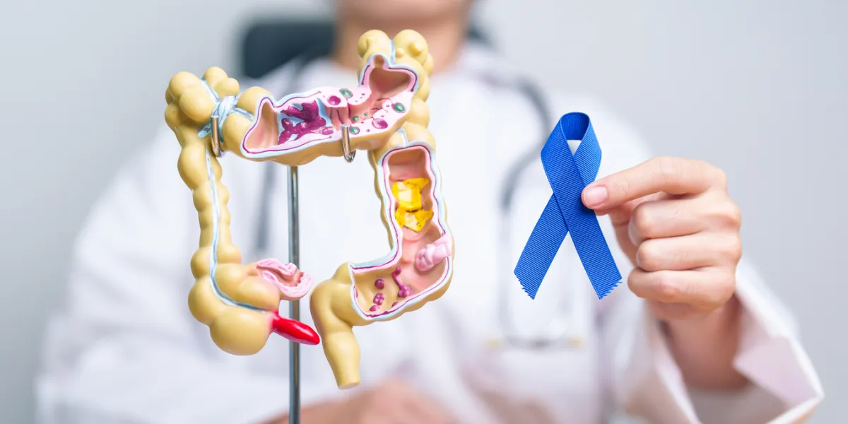 cancer colorectal aspirine