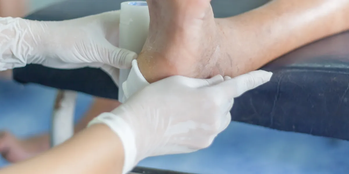 Ulcère de pieds diabétique