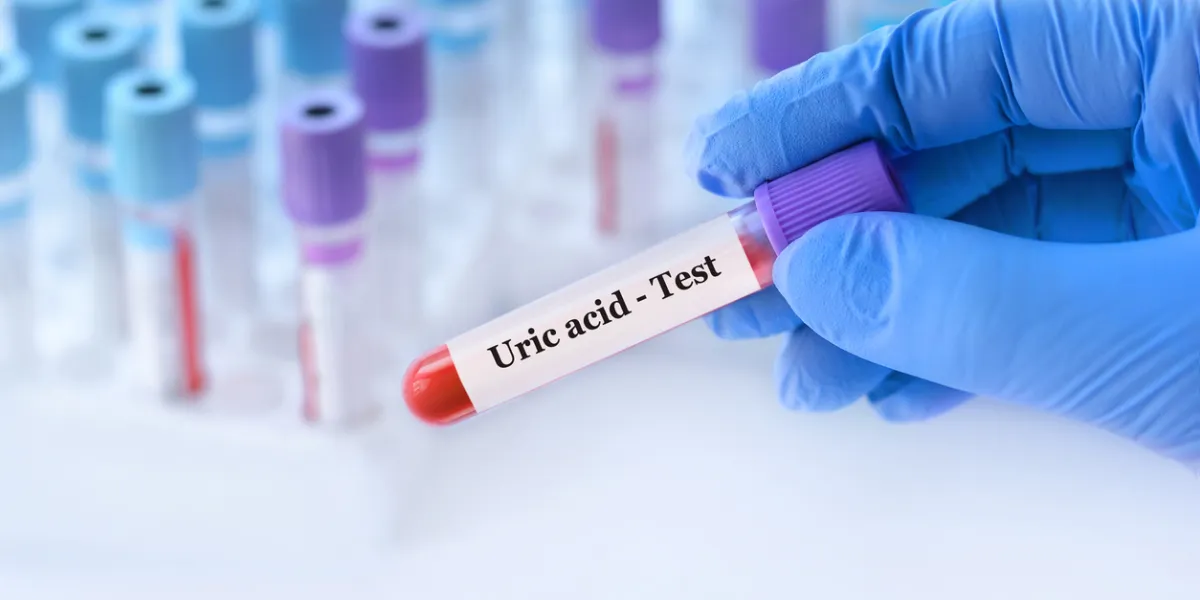 taux d'acide urique