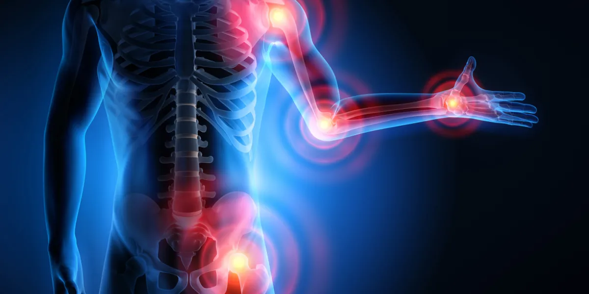 inflammation chronique