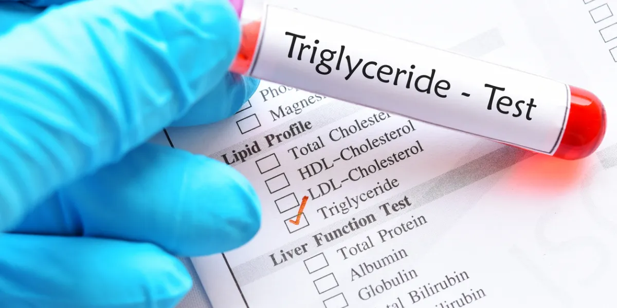 triglycérides alimentaires